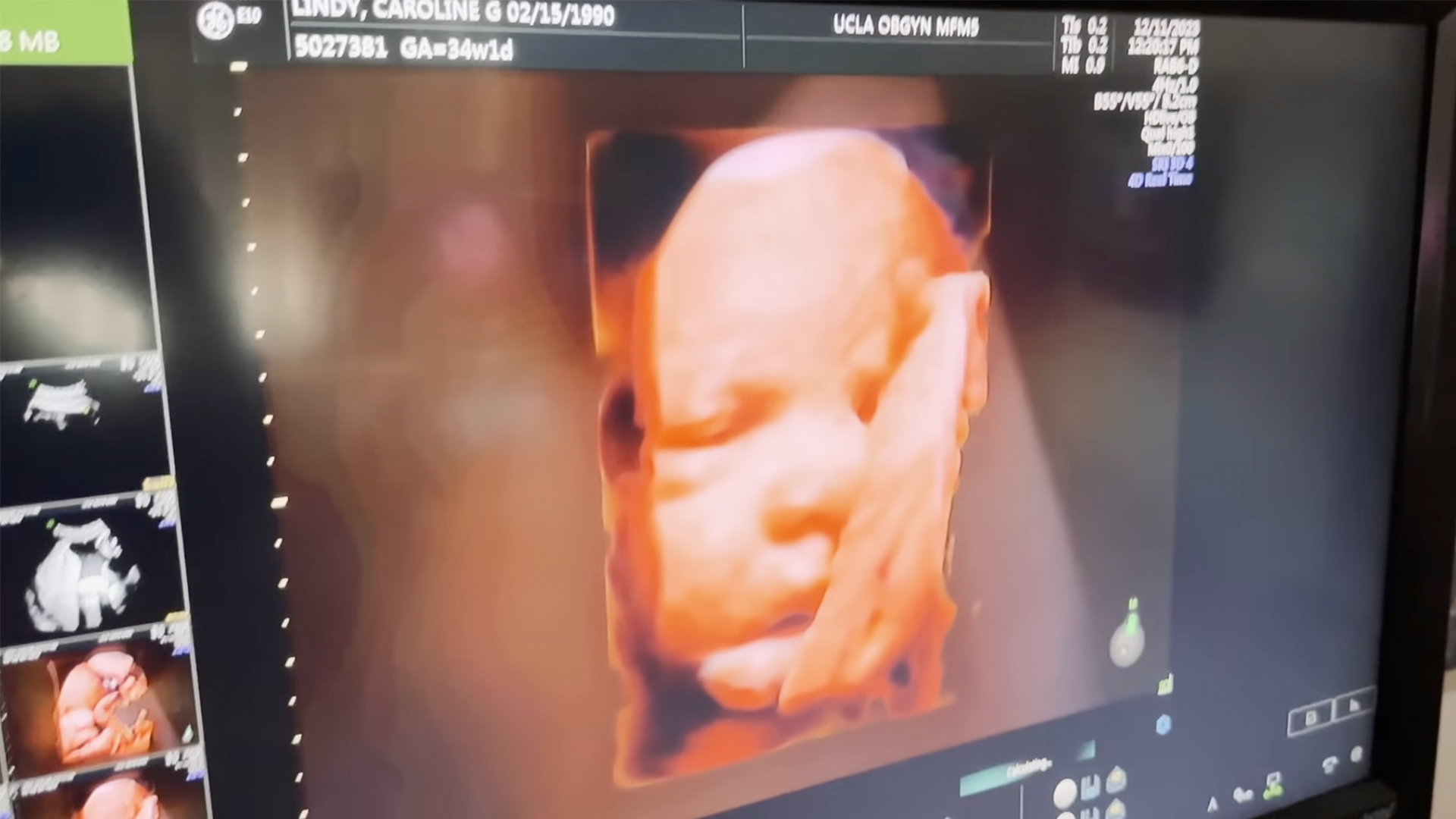 The AI Doc: Or How I Became an Apocaloptimist